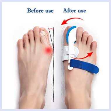 Orthotics: Do they really work?